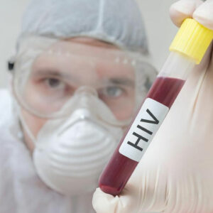 Diagnosis of HIV AIDS – A proper treatment starts with proper diagnosis