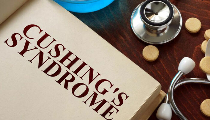 The symptoms of Cushing’s disease