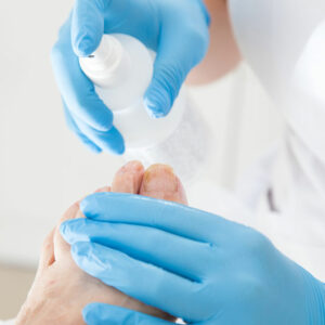 Toenail Fungus – Symptoms and Treatment Methods